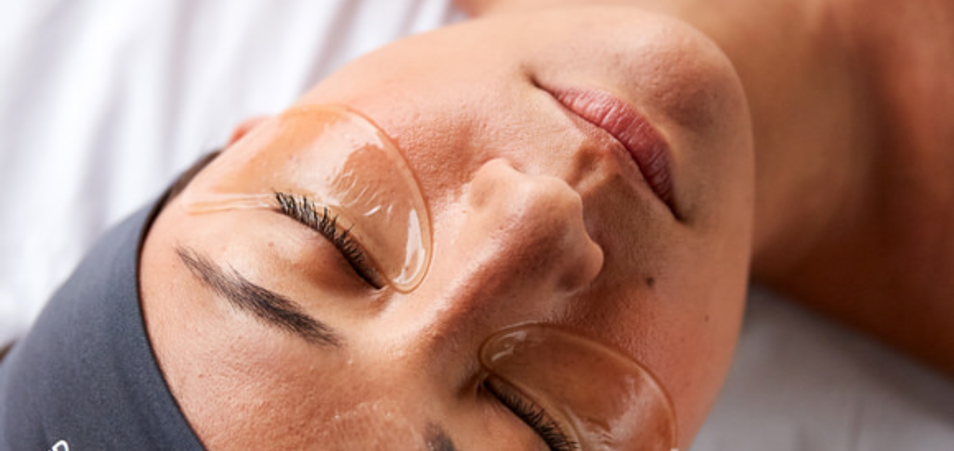 Prescription Peels